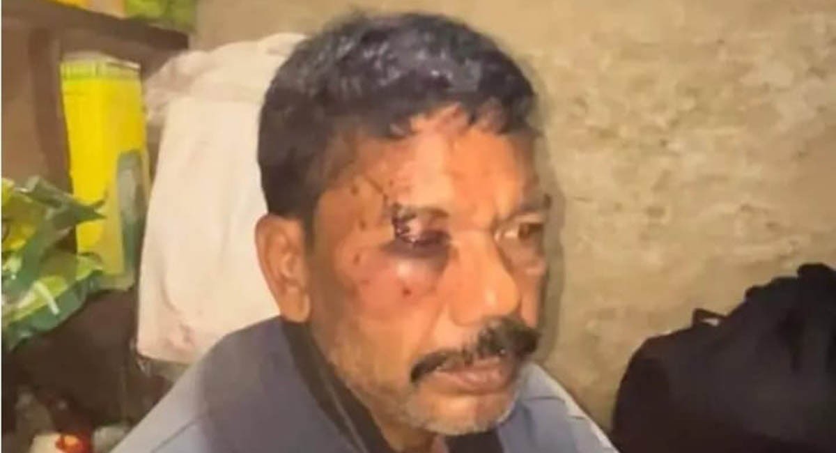 मन्दिरमा पसेका दलितमाथि कुटपिट:  वडाध्यक्ष पक्राउ