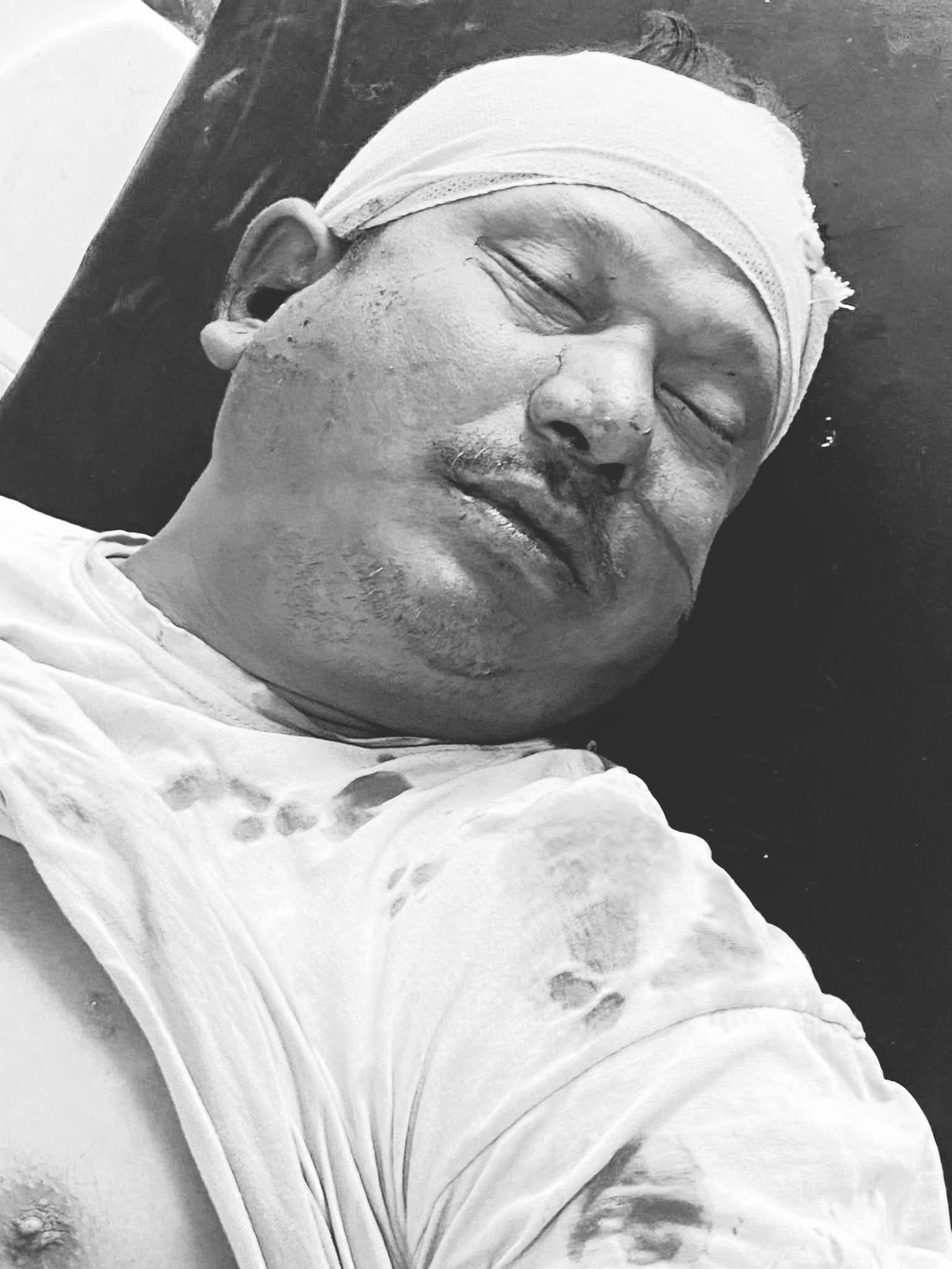 बसको ठक्करबाट ज्यान गुमाएकाको सनाखत: मृतक र घाइते वडा नं ६ कै
